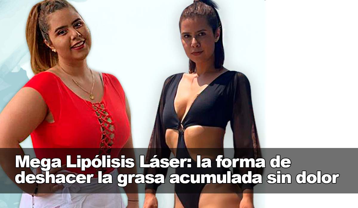 La Mega Lipólisis Láser: la forma de deshacerse de la grasa acumulada sin dolor