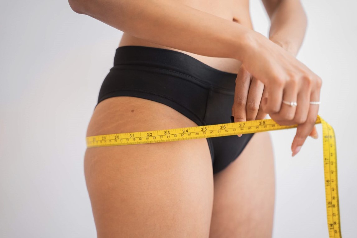 Lipoescultura láser en Cali (Colombia): un procedimiento eficaz para eliminar grasa no deseada